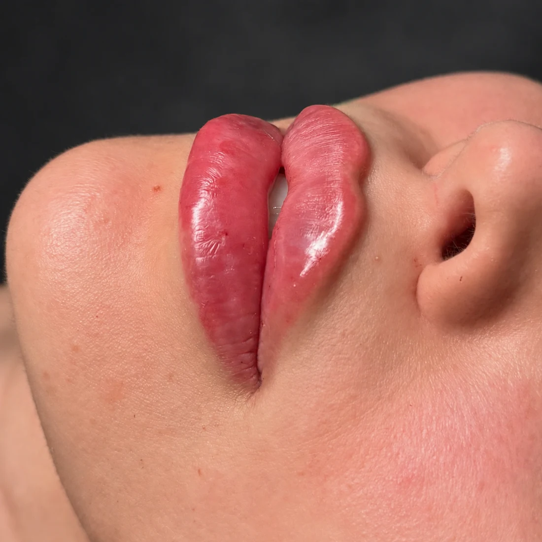 Close-up of Dr. Teska's Classic Flat Lips work
